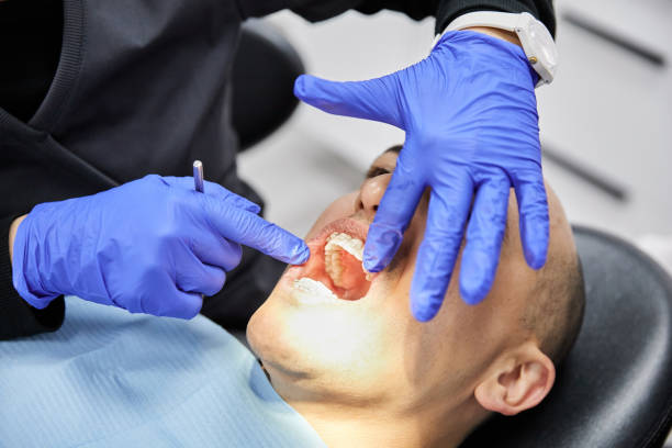 Best Emergency Cosmetic Dentistry (e.g., broken veneers) in Hays, KS